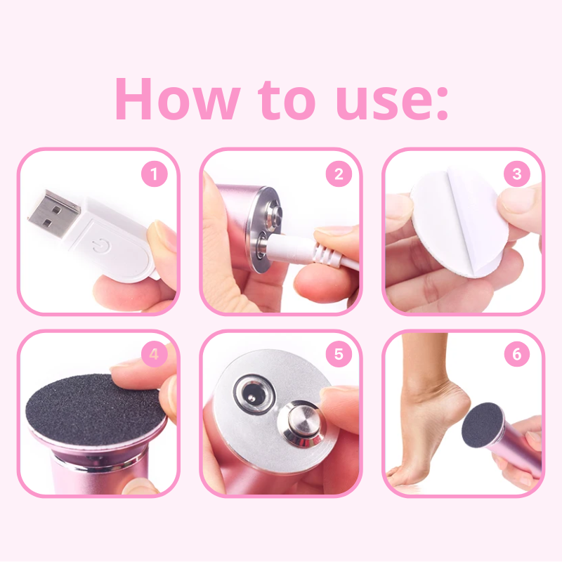 SoleRenew - Electric Callus Remover